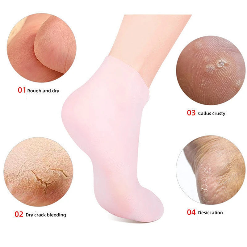 Silicone Moisturizing Socks